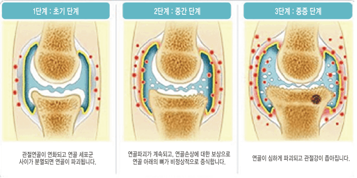 이미지명